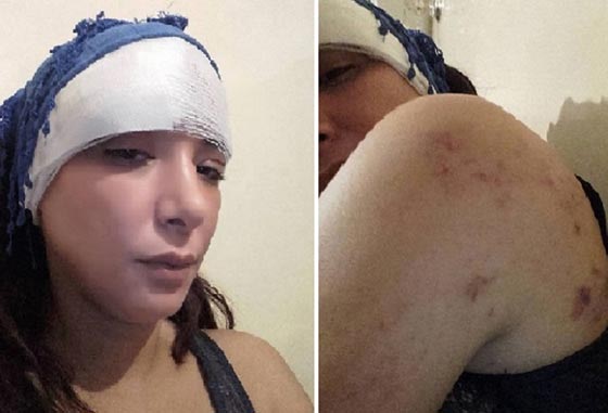 الاعتداء على مغربية مثلت دور مومس.. حادث يخلو من التفاصيل! صورة رقم 2 الاعتداء على مغربية مثلت دور مومس.. حادث يخلو من التفاصيل! صورة رقم 2