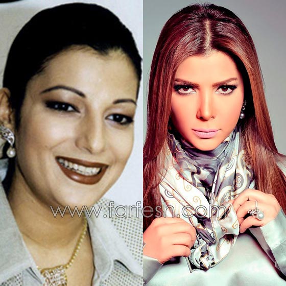 صور فنانات عربيات قبل وبعد الشهرة: صرن اجمل مع تقدم العمر صورة رقم 5
