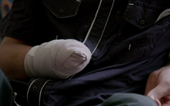  البلدوزر يقطع يد وقدم شاب سوري لانه قال لا لداعش.. شاهد صورة رقم 4