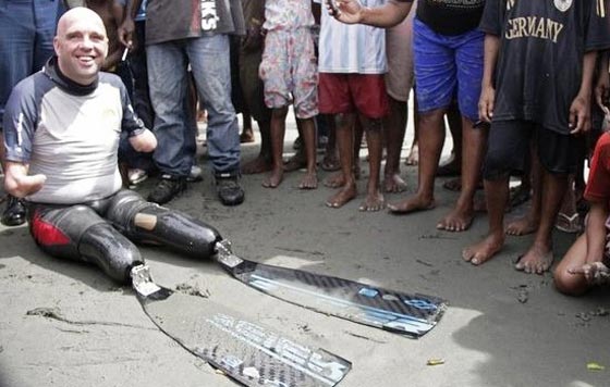 اغرب من الخيال: صور ابطال تحدوا اعاقتهم وأبدلوا اليأس بالامل صورة رقم 1