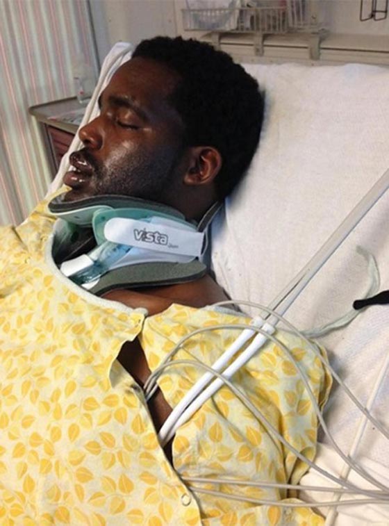 ثاني حادثة خلال يومين.. سيجارة الكترونية تنفجر وتشوه وجه رجل صورة رقم 2