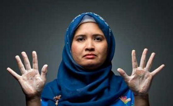 خوفها من الايدز جعلها تستحم 25 مرة يوميا وتغسل يديها 300 مرة صورة رقم 1