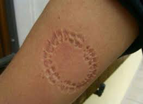 معلمة في مدرسة كويتية تعض طالبة عقابا لها صورة رقم 1