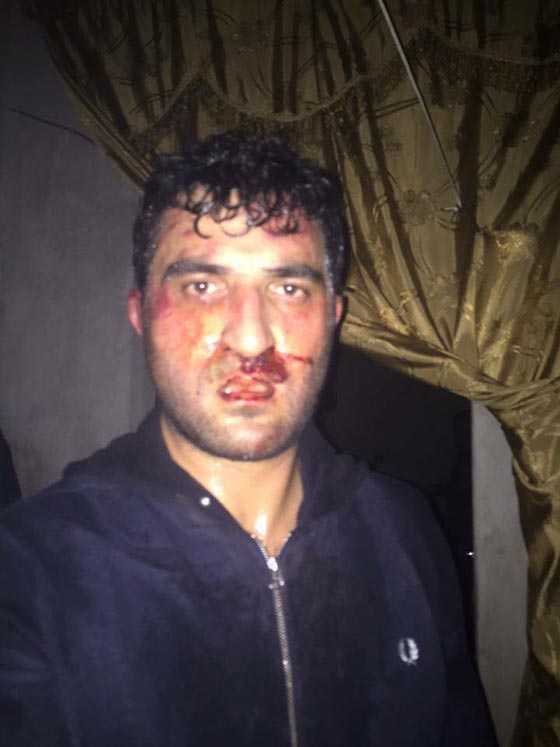 صحافي سوري مقيم بتركيا يتعرض للضرب المبرح من الجيش التركي صورة رقم 2 صحافي سوري مقيم بتركيا يتعرض للضرب المبرح من الجيش التركي صورة رقم 2
