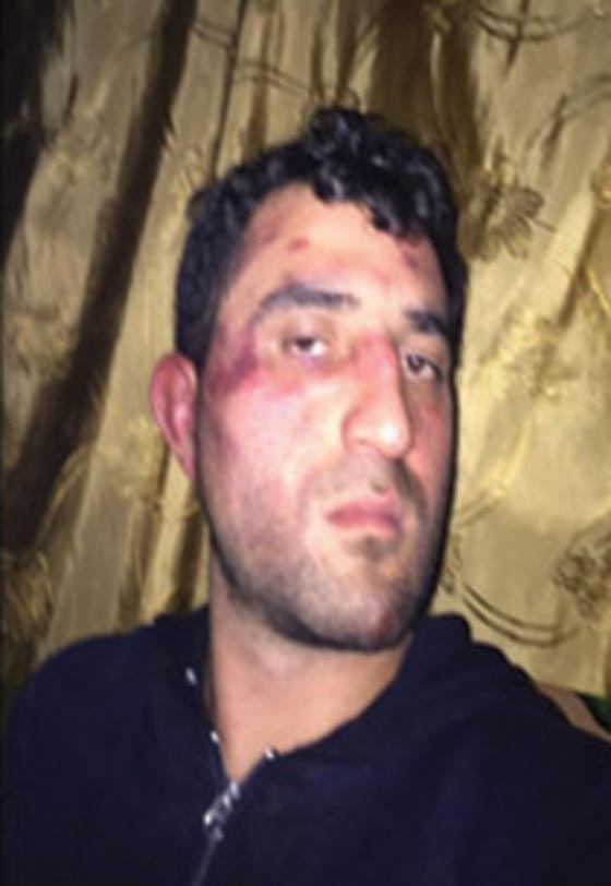 صحافي سوري مقيم بتركيا يتعرض للضرب المبرح من الجيش التركي صورة رقم 3 صحافي سوري مقيم بتركيا يتعرض للضرب المبرح من الجيش التركي صورة رقم 3