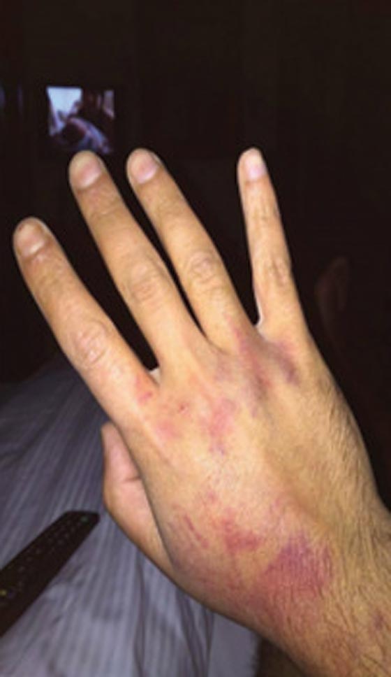 صحافي سوري مقيم بتركيا يتعرض للضرب المبرح من الجيش التركي صورة رقم 4 صحافي سوري مقيم بتركيا يتعرض للضرب المبرح من الجيش التركي صورة رقم 4