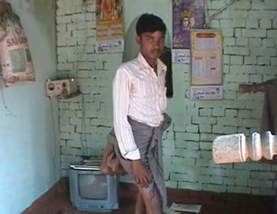 من عجائب الخلق.. شاب هندي يمتلك 4 ارجل اثنتان منها في ظهره!! صورة رقم 1 من عجائب الخلق.. شاب هندي يمتلك 4 ارجل اثنتان منها في ظهره!! صورة رقم 1