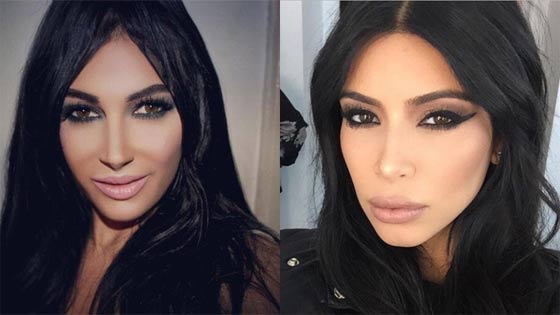 صور اشهر 10 عمليات تجميل لمعجبين ارادوا التشبه بالمشاهير صورة رقم 1