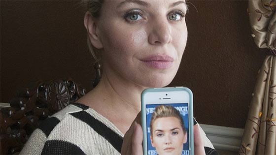 صور اشهر 10 عمليات تجميل لمعجبين ارادوا التشبه بالمشاهير صورة رقم 8
