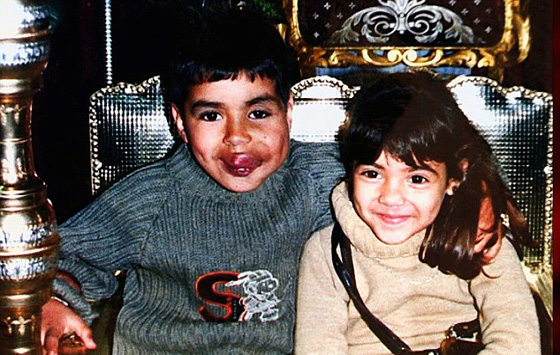 ازالة ورم عملاق من وجه شاب مغربي بعد معاناة طويلة صورة رقم 4 ازالة ورم عملاق من وجه شاب مغربي بعد معاناة طويلة صورة رقم 4