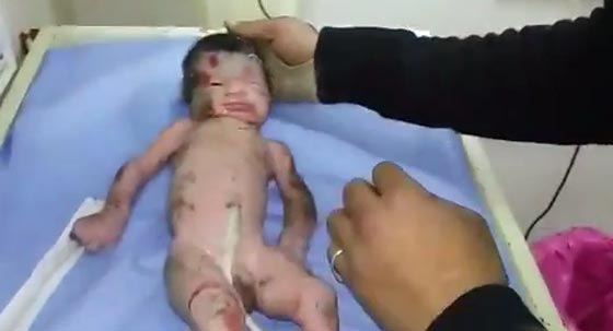 لقطات مؤلمة لام تقذف رضيعها من الطابق الثالث مثل كرة!! صورة رقم 3 لقطات مؤلمة لام تقذف رضيعها من الطابق الثالث مثل كرة!! صورة رقم 3