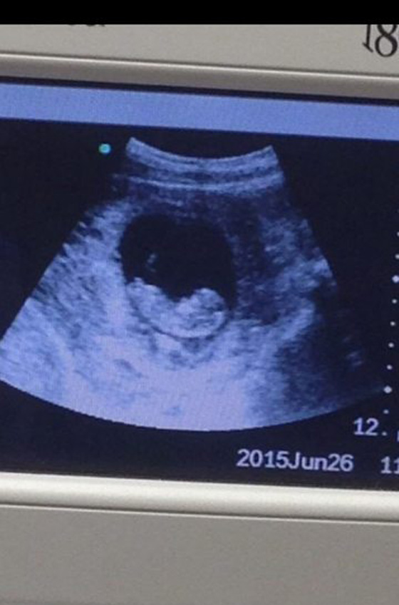 ضجة حول جنين في بطن امه.. بطلها شيطان صورة رقم 2