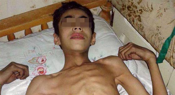  صور من داخل الحصار.. امعاء فارغة في مضايا وشبح الموت يخطف الجياع صورة رقم 3