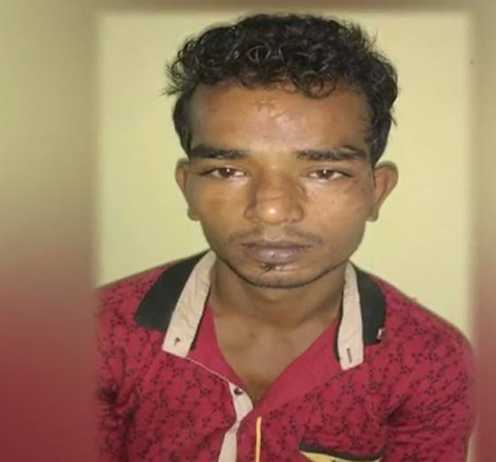 الشرطة الهندية تستخرج قلادة من بطن سارق باطعامه الموز صورة رقم 1