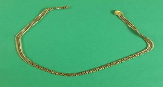 الشرطة الهندية تستخرج قلادة من بطن سارق باطعامه الموز صورة رقم 2