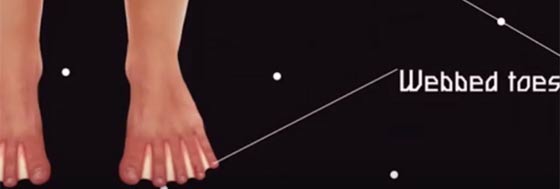 تصور فريد لانسان الفترة القادمة.. اطرافه ستصبح ملائمة للسباحة!! صورة رقم 4 تصور فريد لانسان الفترة القادمة.. اطرافه ستصبح ملائمة للسباحة!! صورة رقم 4