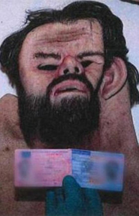 طبيب خدّر صديقته وخطفها لـ6 ايام بهدف مضاجعتها دون وسيلة وقاية صورة رقم 2 طبيب خدّر صديقته وخطفها لـ6 ايام بهدف مضاجعتها دون وسيلة وقاية صورة رقم 2