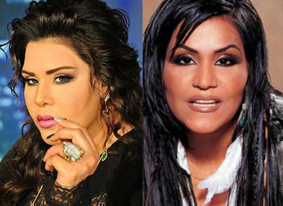    فيديو فنانات ينكرن اجراء عمليات تجميل، بينما صور (قبل وبعد) تفضح كذبهن!   صورة رقم 7