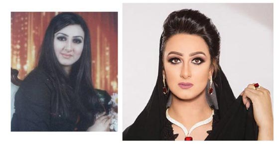    فيديو فنانات ينكرن اجراء عمليات تجميل، بينما صور (قبل وبعد) تفضح كذبهن!   صورة رقم 3