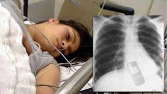 فتاة تبتلع هاتفها خوفا من يكتشف صديقها خيانتها له صورة رقم 1