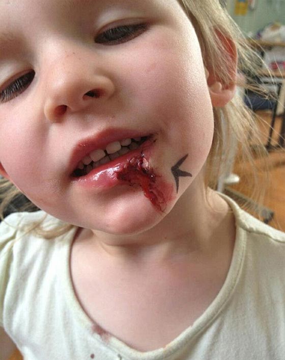 الفتاة الالكترونية البريطانية تحير الاطباء.. بقوتها وعدم استسلامها للنوم صورة رقم 8