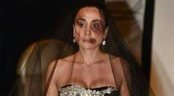 ساروهان.. التركي الاسمر فاتن الحسناوات يدفع ثمنا غاليا لتعنيفه حبيبته صورة رقم 6