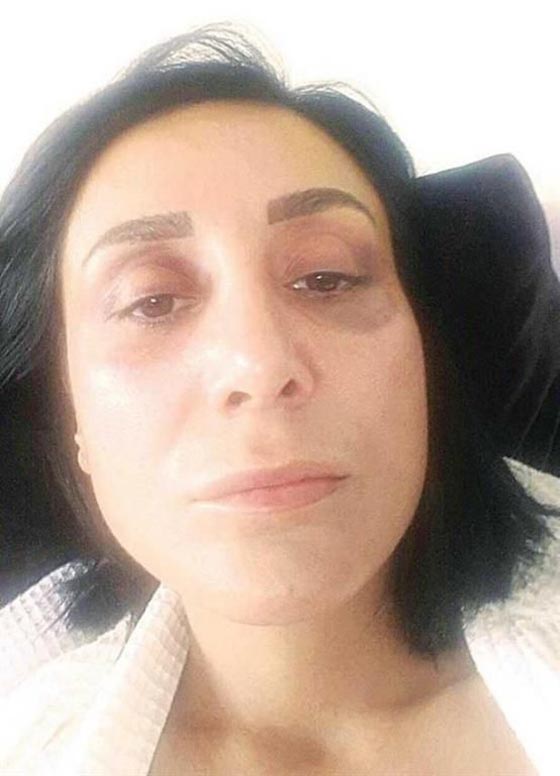 ساروهان.. التركي الاسمر فاتن الحسناوات يدفع ثمنا غاليا لتعنيفه حبيبته صورة رقم 7