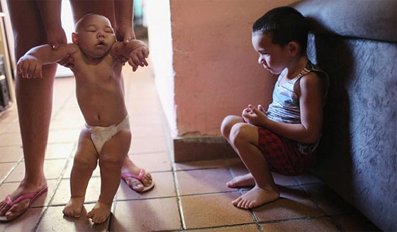 خبيرة عالمية تكشف عن اسرار زيكا الخطيرة على عالمنا العربي ايضا صورة رقم 13