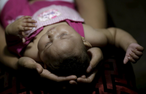 خبيرة عالمية تكشف عن اسرار زيكا الخطيرة على عالمنا العربي ايضا صورة رقم 17