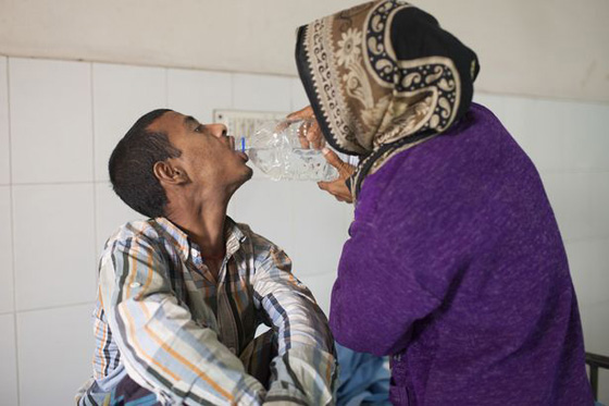 شاب يتحول الى شجرة.. وهذا هو السبب صورة رقم 2 شاب يتحول الى شجرة.. وهذا هو السبب صورة رقم 2