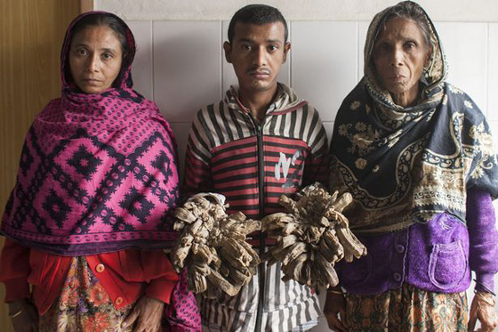 شاب يتحول الى شجرة.. وهذا هو السبب صورة رقم 7 شاب يتحول الى شجرة.. وهذا هو السبب صورة رقم 7