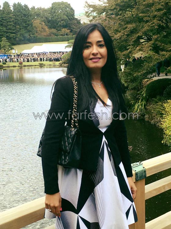 الفنانة انجي عبد الله توضح من جديد: لهذا لن تنفعني عملية إزالة الورم من المخ  صورة رقم 4