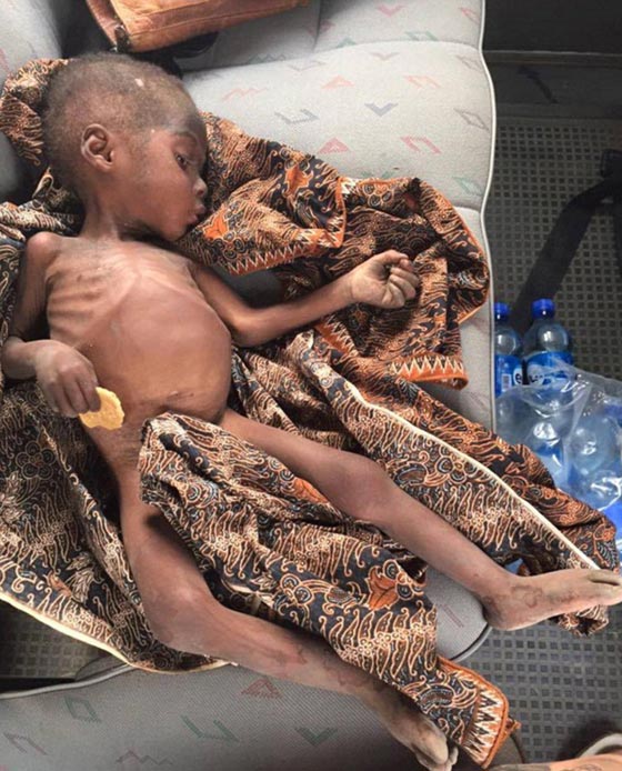 لاعتقادها انه ساحر.. عائلة تحرم طفلا من الطعام مدة 8 اشهر صورة رقم 2