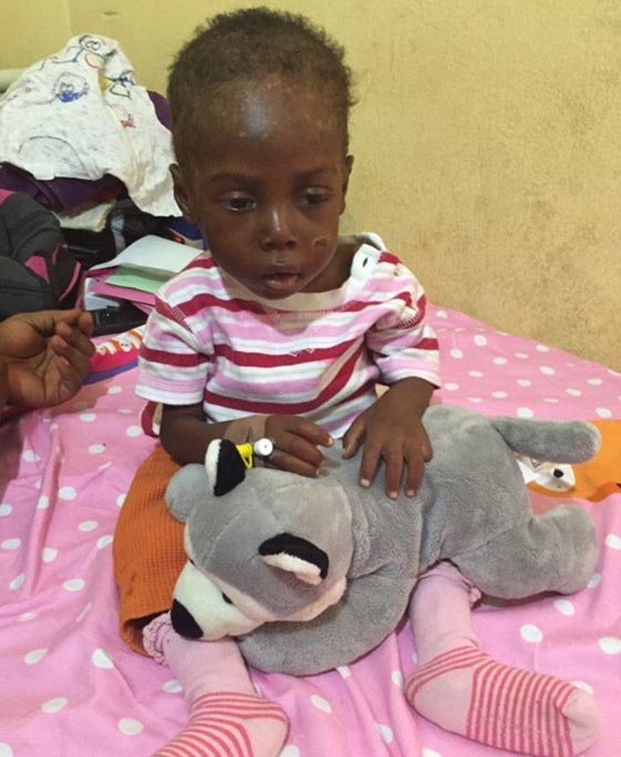 لاعتقادها انه ساحر.. عائلة تحرم طفلا من الطعام مدة 8 اشهر صورة رقم 6