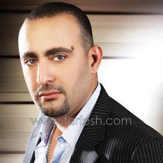 صور فنانين ميزتهم علامات  في وجوههم.. منهم احمد السقا وتامر حسني صورة رقم 1