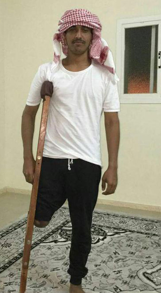 مقاتل يمني يخوض المعارك برجل واحدة.. اطلقوا عليه اسم سيلفر الجنوب صورة رقم 2