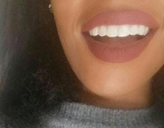 ثورة نسائية عارمة.. والسبب اهانة عنصرية لفتاة اوغندية صورة رقم 18