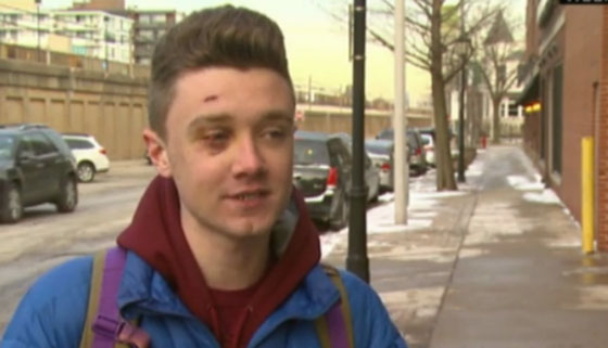 كاميرا مثبتة على خوذة راكب دراجة هي الشاهد الوحيد على اعتداء عنيف صورة رقم 1