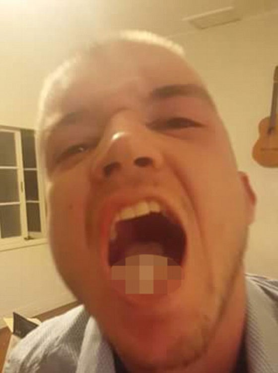 شاب يمثل امام القضاء لانه قضم رأس جرذ صورة رقم 2