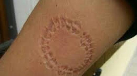 السجن 3 سنوات لشاب عض شرطي مرور بسبب مخالفة سير صورة رقم 1