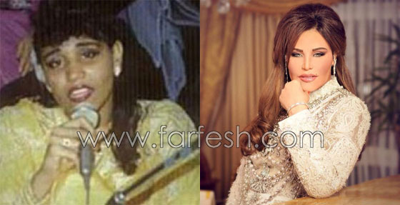  صور فنانين عرب وعالميين قبل وبعد الشهرة.. لن تصدّق الفرق! صورة رقم 17