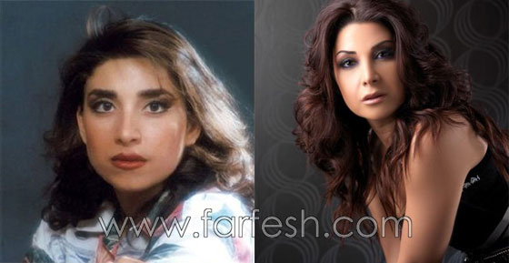  صور فنانين عرب وعالميين قبل وبعد الشهرة.. لن تصدّق الفرق! صورة رقم 26