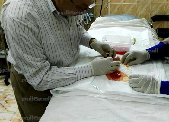 صور صادمة: اطباء مذهولون يستخرجون جنينا من بطن طفلة مصرية!  صورة رقم 12