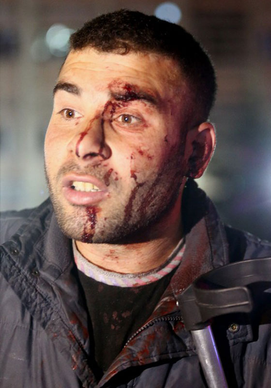 34 قتيلا في تفجير سيارة مفخخة بانقرة ونجاة السفير الاسترالي صورة رقم 29