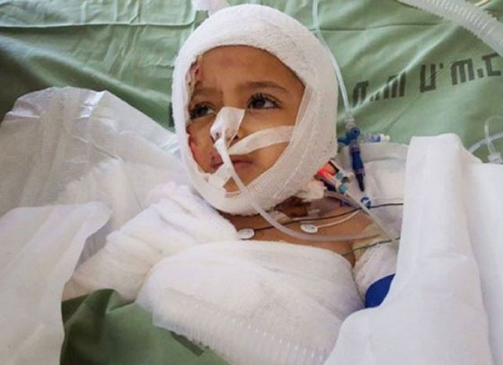 السنة النار تلتهم بيت الشاهد الاول في احراق بيت الدوابشة صورة رقم 6