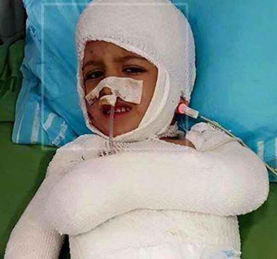 السنة النار تلتهم بيت الشاهد الاول في احراق بيت الدوابشة صورة رقم 7