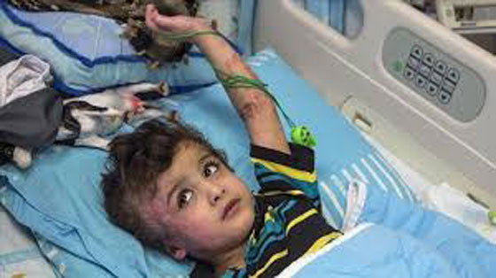 السنة النار تلتهم بيت الشاهد الاول في احراق بيت الدوابشة صورة رقم 8