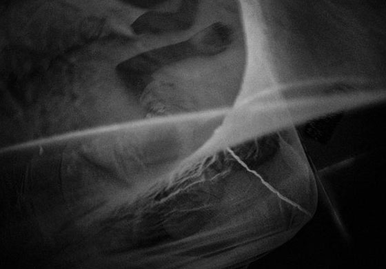 افريقيا : لقطات تقشعر لها الابدان من مدارس لتحفيظ القرآن الكريم صورة رقم 10