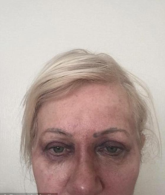 امرأة بريطانية تبذر 60 الف دولار على التجميل لتصبح شبيهة ابنتها! صورة رقم 11