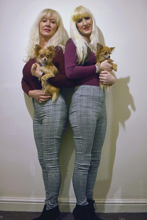 امرأة بريطانية تبذر 60 الف دولار على التجميل لتصبح شبيهة ابنتها! صورة رقم 6